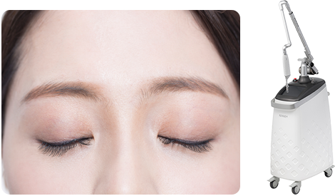 Forehead line